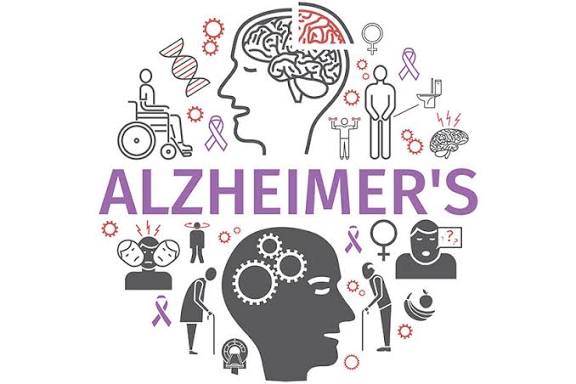 अल्जाइमर रोग